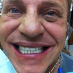 Smile Gallery: Grinning Dental Patient in Willow Grove, PA