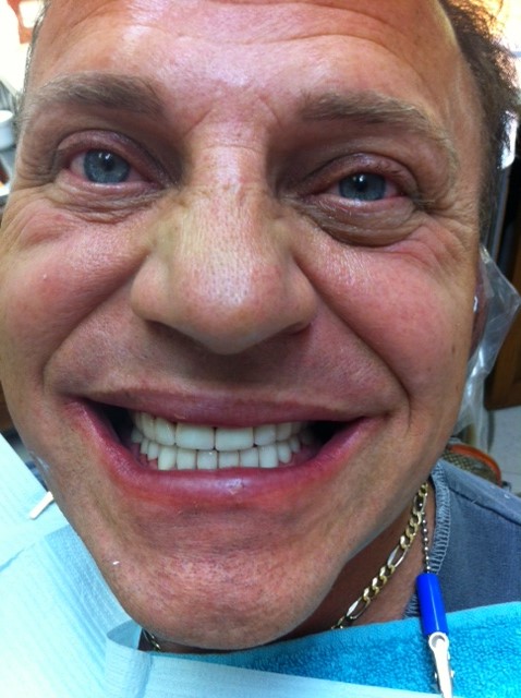 Smile Gallery: Grinning Dental Patient in Willow Grove, PA