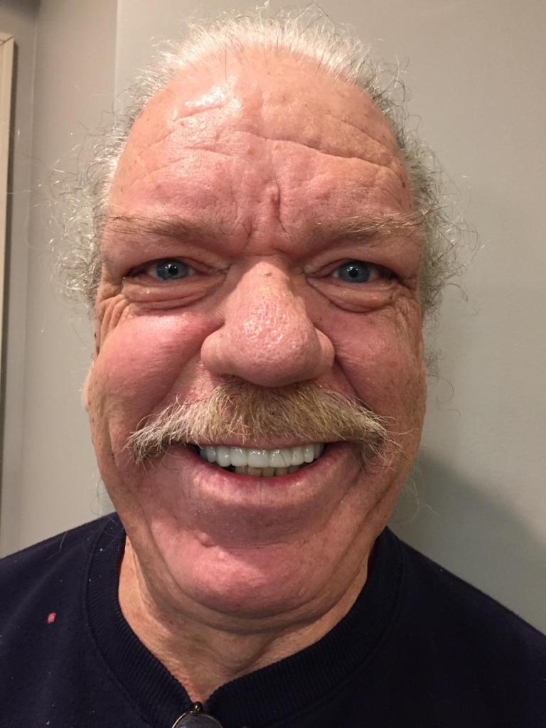 Smile Gallery: Older Dental Patient in Willow Grove, PA